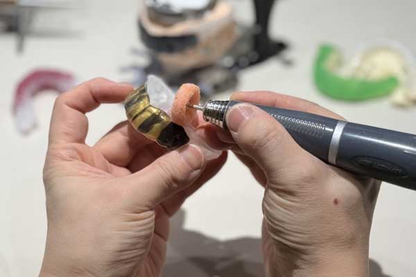 スポーツ歯科専門家による設計